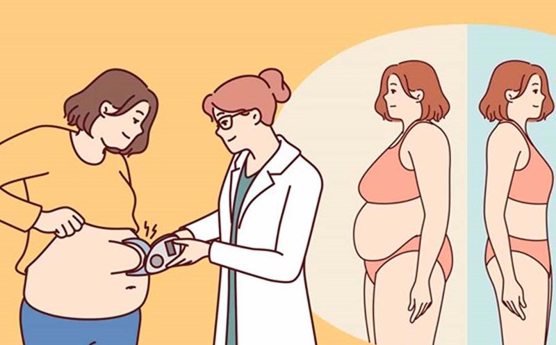Các loại mỡ bụng