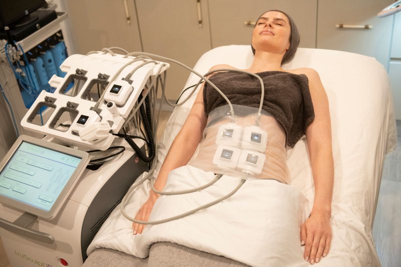 Giảm mỡ bụng không xâm lấn: Giải pháp làm đẹp an toàn, hiệu quả